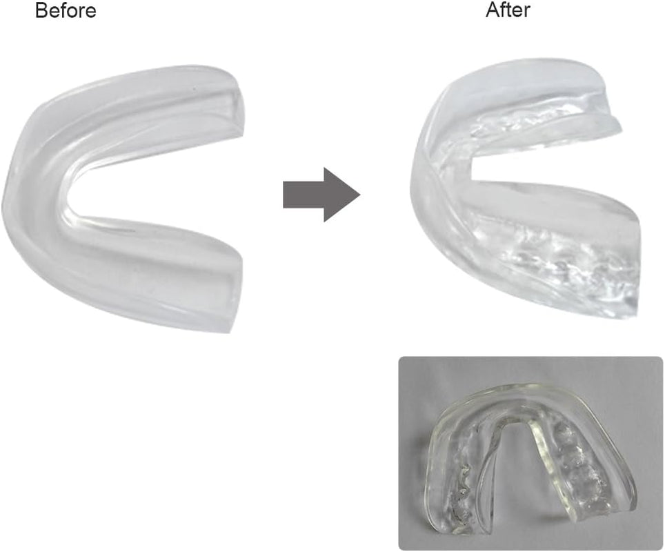 4Set Sports Mouldable Sports Mouth Guards for Adults & Kids,Tooth Protector for Football,Basketball,Boxing,Wrestling,Kickboxing - BPA Free Material (Chroma)